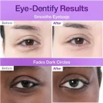 پچ دور چشم نامبوزین شماره ۹+ - Image 3